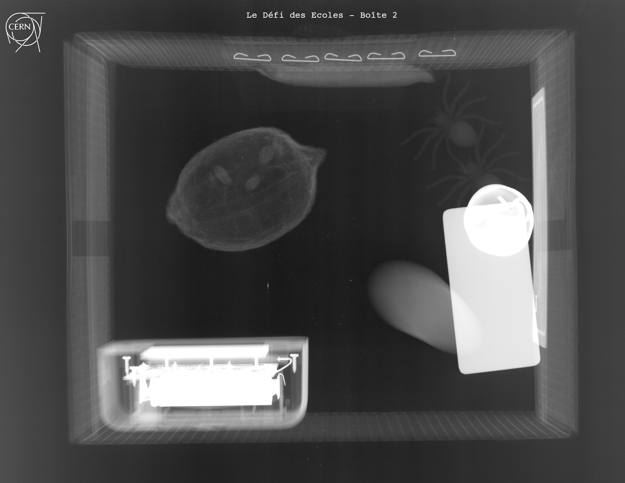 X-ray of the French box 